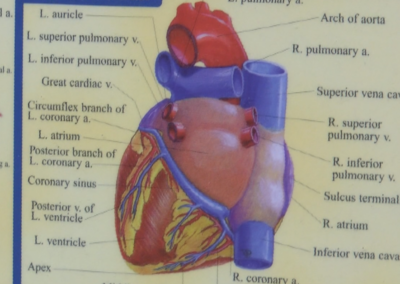 Heart disease is the leading cause of death for women in the U.S., doctors say take care of your heart before it’s too late | Community | wlfi.com