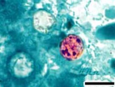 Parasitic infections likely linked to farming practices | NC Health News