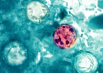 Taco Bell lettuce in 5 states, supplied by Taylor Farms, source of cyclospora outbreak – al.com
